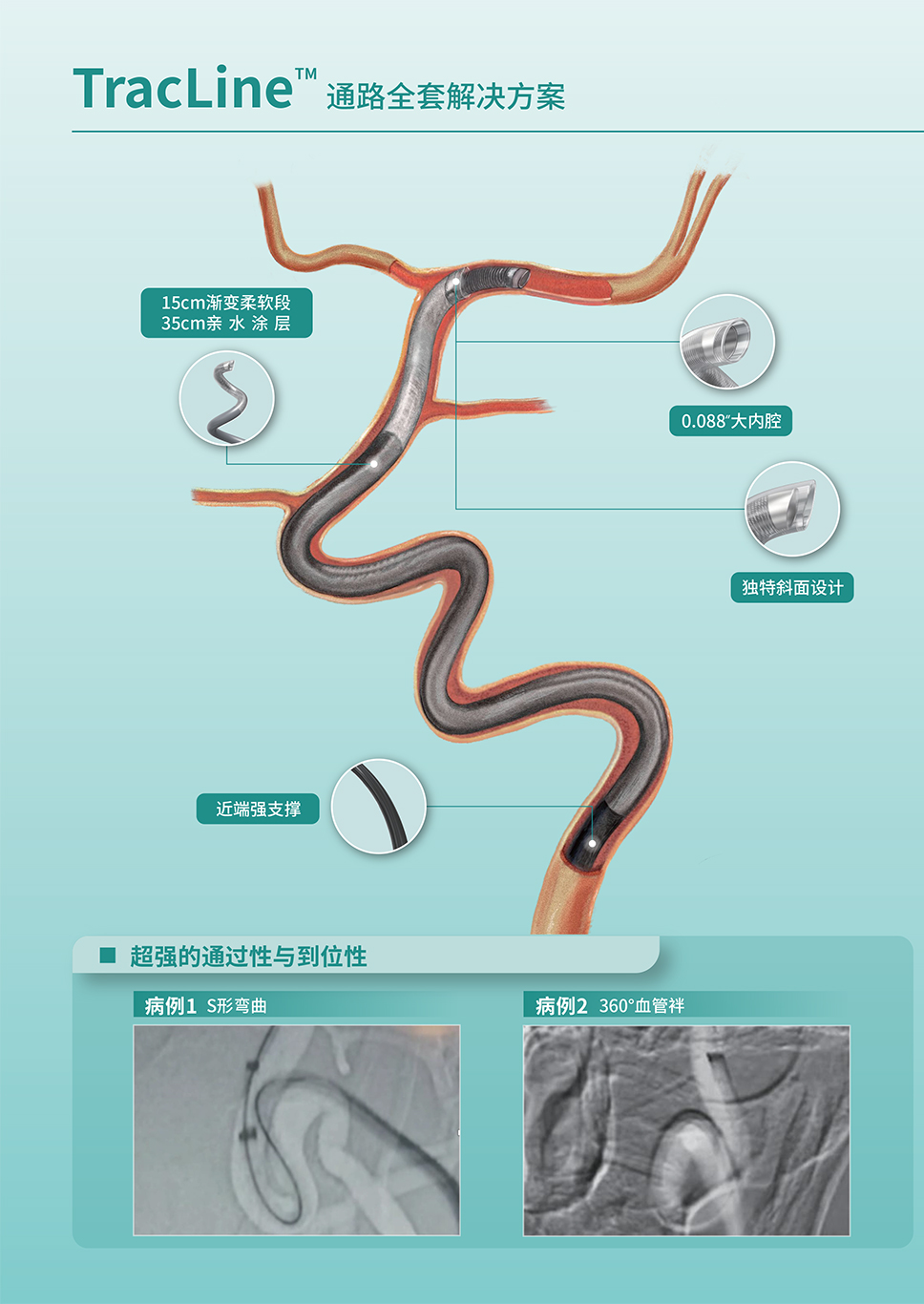 禾木TracLine血管内通路导管.jpg